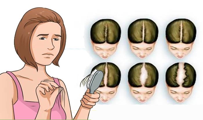 טיפולים לצמיחת השיער