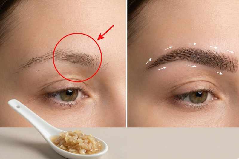 המסכה המסריחה מבצל שגורמת לגבות לצמוח מחדש תוך חודש