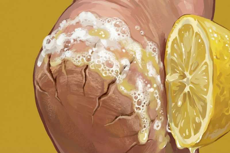 ככה מעלימים סדקים בכפות הרגליים עם סודה לשתייה ולימון