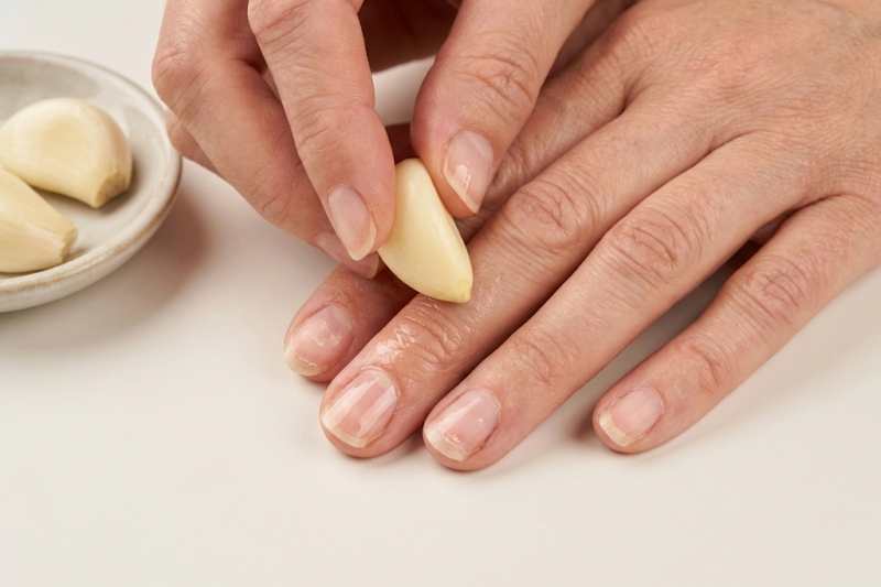 ציפורניים חלשות? הטריק עם שן השום שיחזק אותן בתוך שבוע